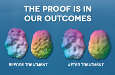 SPECT scan (http://www.amenclinics.com/images/pdf/SpecificWaysBrainSpectImagingEnhancesPsychiatricPractice2012.pdf)