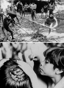 Top: two men duel over the infidelity of one of their wives. Bottom: many Yanomamo men have masses of scar tissue on their heads from such battles